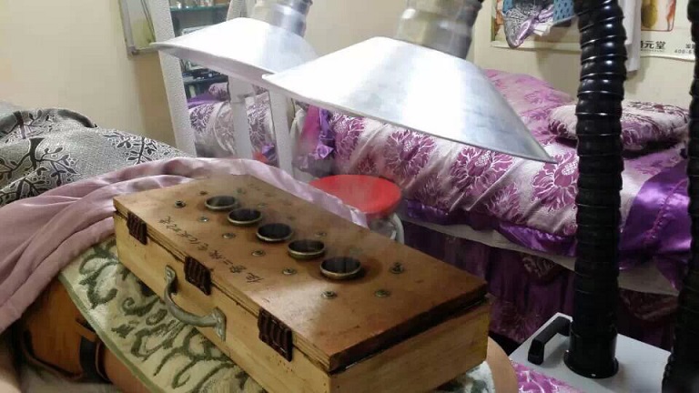 艾灸排烟机 艾灸排烟机